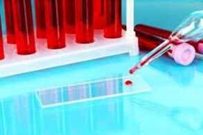 Hemosia of blood drops for parasites