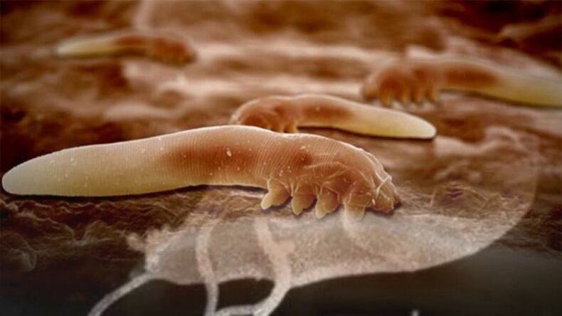 Parasites