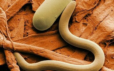 Causes of worms in people