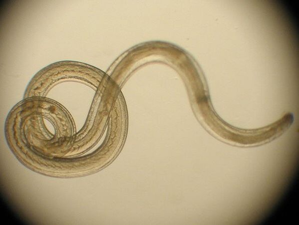 Trichinella is a type of human parasite