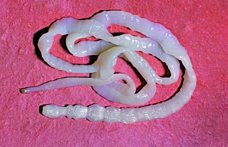 Cattle tapeworm is a common intestinal worm.
