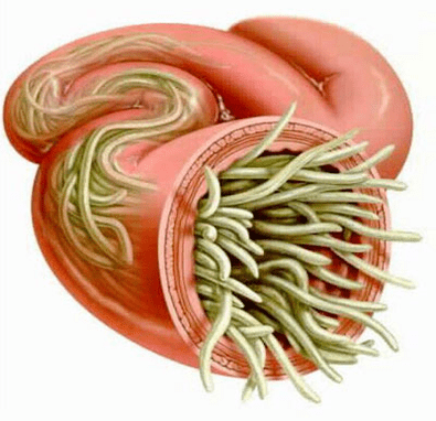 globular worm in human intestines