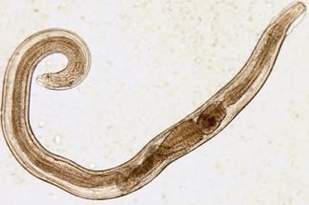 pinworms in the human body