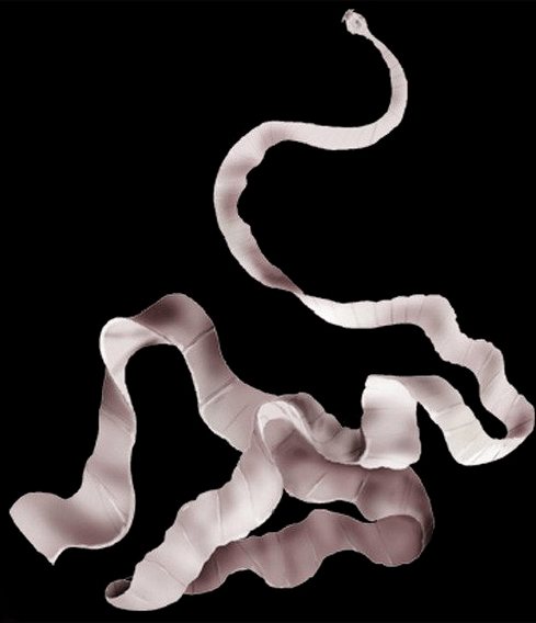 what does the pig tapeworm look like in the human body