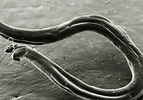 what hookworms look like in the human body